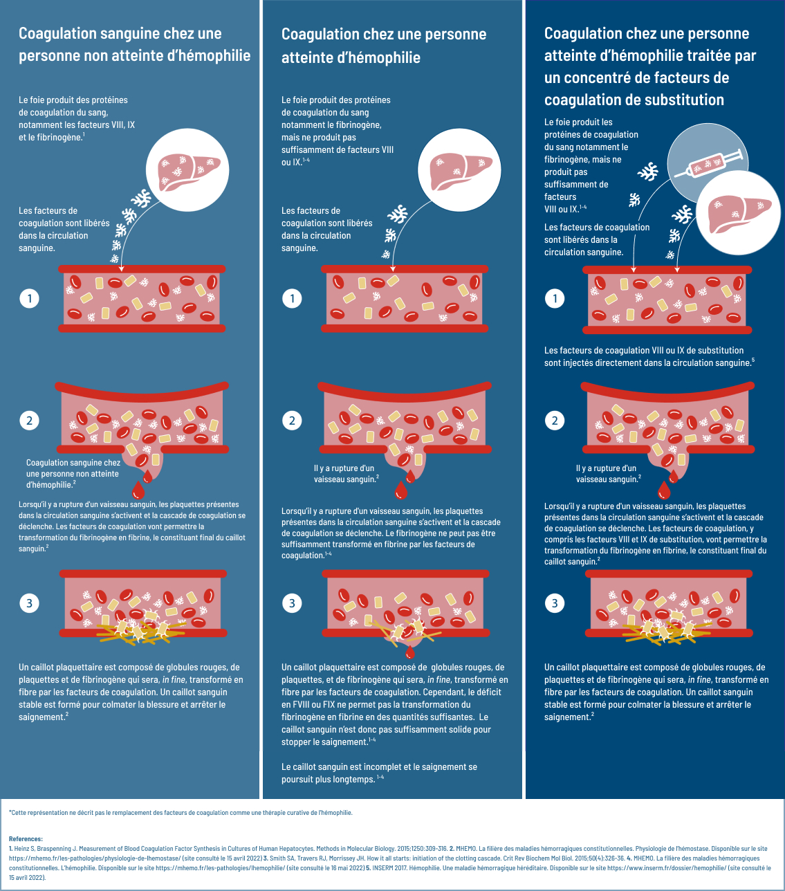 Différence entre la coagulation sanguine normale chez une personne qui n'est pas atteinte d'hémophilie, la coagulation sanguine dans l'hémophilie et la thérapie de remplacement des facteurs (prophylaxie).
